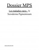 Mps xeroderma pigmentosum