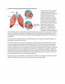 La cause de la broncho-pneumopathie chronique obstructive