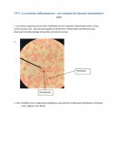 La réaction inflammatoire : un exemple de réponse immunitaire inée