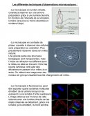 Microscopie et son histoire