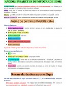 Infarctus du myocarde