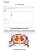 Le réflexe myotatique