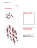 TP terminale glucose